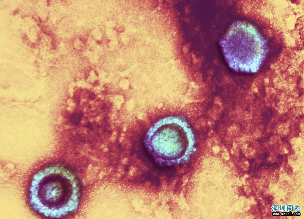 终于能治愈艾滋病了?美科学家取得巨大突破,消除31%HIV突变类型 终于能治愈艾滋病了?美科学家取得巨大突破,消除31%HIV突变类型