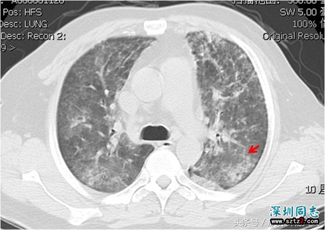 放射科大夫指着一张CT片问:你是同性恋吗? 放射科大夫指着一张CT片问:你是同性恋吗?