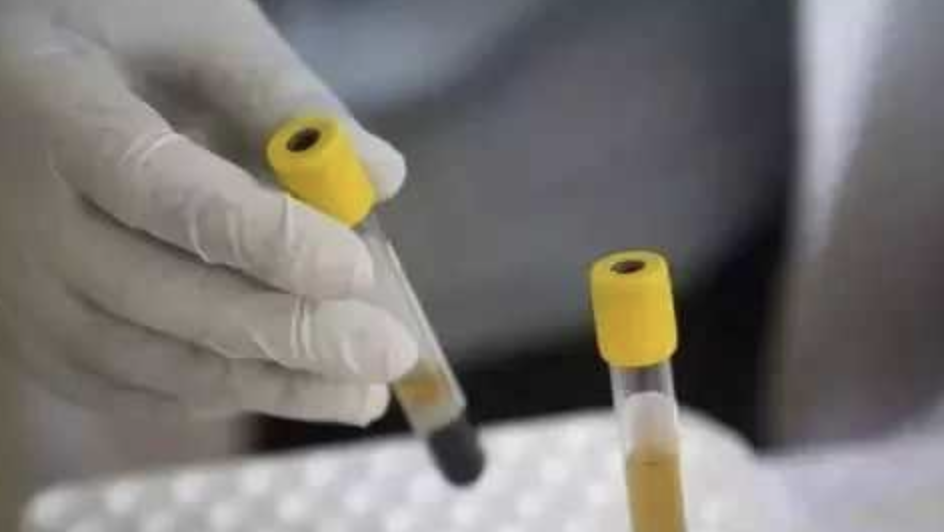 24岁大学生确诊艾滋当场大哭:怎么一次就中招 24岁大学生确诊艾滋当场大哭:怎么一次就中招