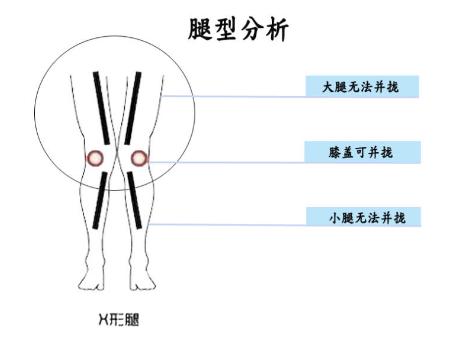X、O型腿牛仔裤选择指南,挑对激发硬汉力度 X、O型腿牛仔裤选择指南,挑对激发硬汉力度