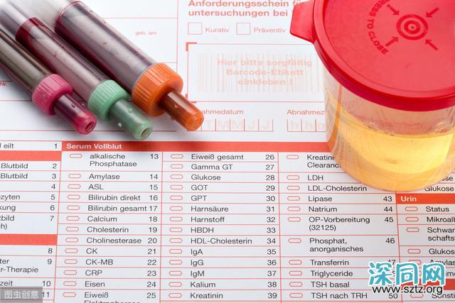 透过晨尿看待男性健康 透过晨尿看待男性健康