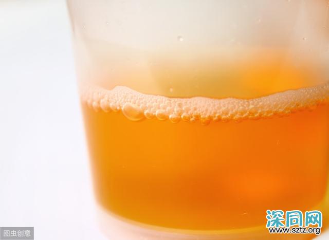 透过晨尿看待男性健康 透过晨尿看待男性健康