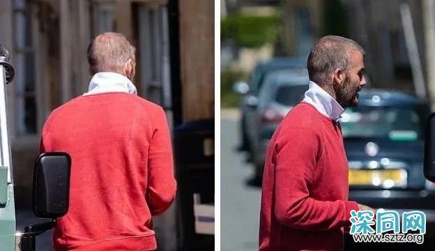 秦昊变“秃头大叔”?男士脱发自救指南要get 秦昊变“秃头大叔”?男士脱发自救指南要get