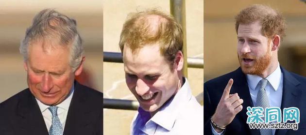 秦昊变“秃头大叔”?男士脱发自救指南要get 秦昊变“秃头大叔”?男士脱发自救指南要get