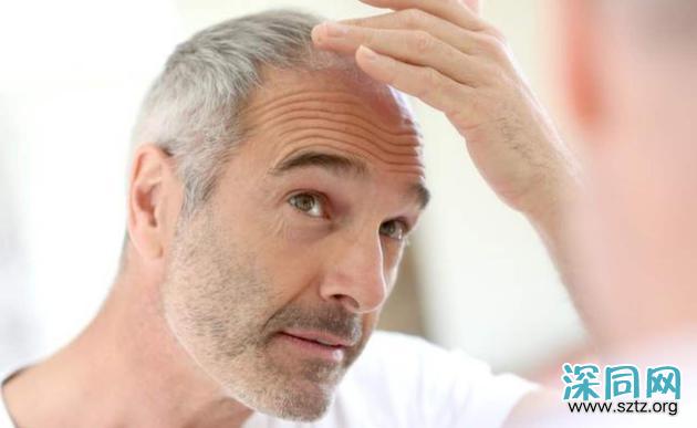 秦昊变“秃头大叔”?男士脱发自救指南要get 秦昊变“秃头大叔”?男士脱发自救指南要get
