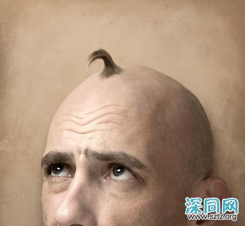 秦昊变“秃头大叔”?男士脱发自救指南要get 秦昊变“秃头大叔”?男士脱发自救指南要get