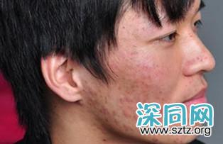 男生怎样做,看上去就会干干净净、不油腻? 男生怎样做,看上去就会干干净净、不油腻?